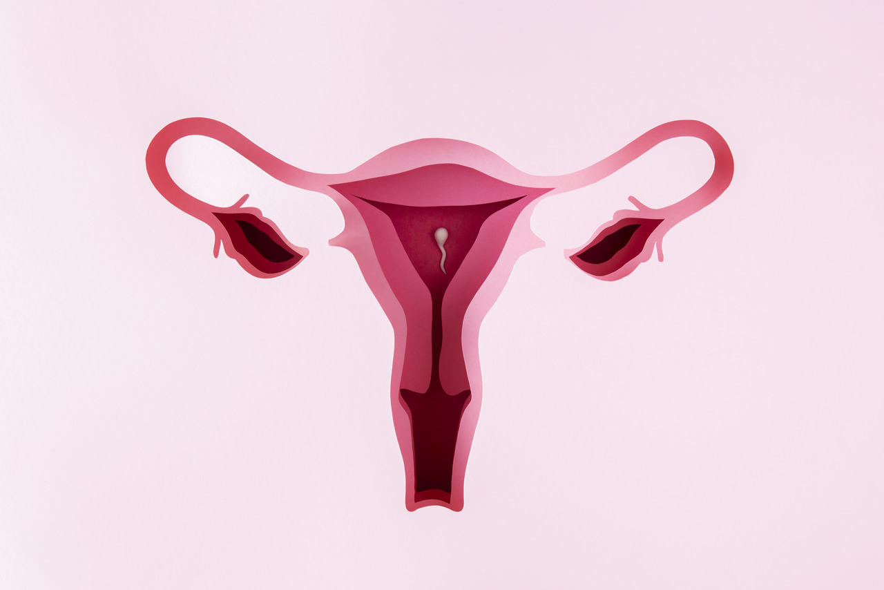 Inseminação intrauterina
